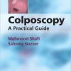 Colposcopy: A Practical Guide