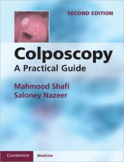 Colposcopy: A Practical Guide