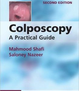 Colposcopy: A Practical Guide