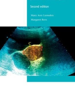 Menstrual Problems for the MRCOG and Beyond