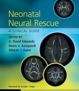 Neonatal Neural Rescue: A Clinical Guide