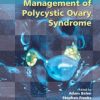 Current Management of Polycystic Ovary Syndrome