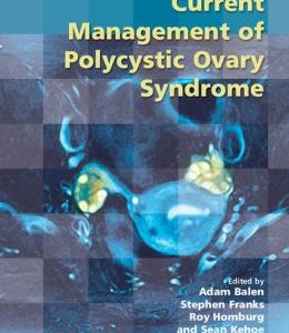 Current Management of Polycystic Ovary Syndrome