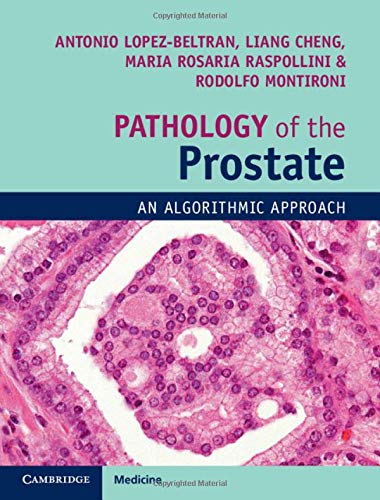 Pathology of the Prostate: An Algorithmic Approach (Converted PDF)