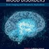 Mood Disorders: Brain Imaging and Therapeutic Implications (Original PDF from Publisher)