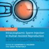 Manual of Intracytoplasmic Sperm Injection in Human Assisted Reproduction (Original PDF from Publisher)
