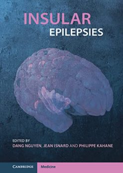 Insular Epilepsies (Original PDF from Publisher)