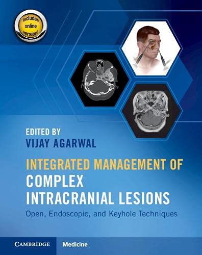 Integrated Management of Complex Intracranial Lesions: Open, Endoscopic, and Keyhole Techniques (Converted PDF+Videos)