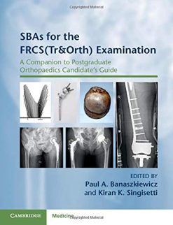 SBAs for the FRCS(Tr&Orth) Examination (A Companion to Postgraduate Orthopaedics Candidate’s Guide) (Original PDF from Publisher)