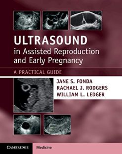 Ultrasound in Assisted Reproduction and Early Pregnancy: A Practical Guide (Original PDF from Publisher)