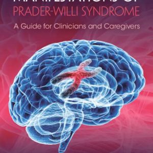 Neuro-behavioral Manifestations of Prader-Willi Syndrome (Original PDF from Publisher)