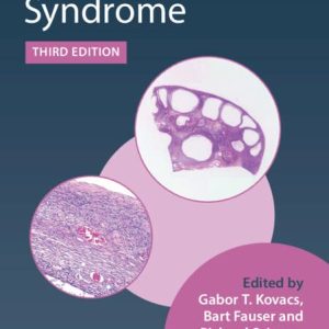 Polycystic Ovary Syndrome, 3rd edition (Original PDF from Publisher)