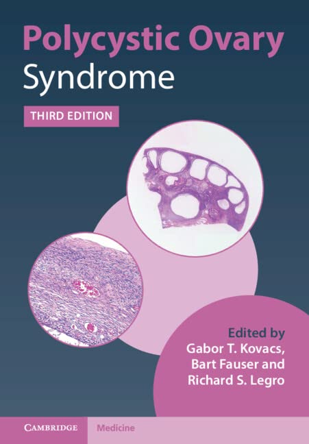Polycystic Ovary Syndrome, 3rd edition (Original PDF from Publisher)