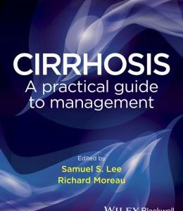 Cirrhosis: A Practical Guide to Management
