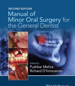 Manual of Minor Oral Surgery for the General Dentist, 2nd Edition