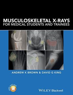 Musculoskeletal X-Rays for Medical Students and Trainees (PDF)