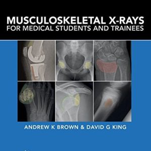 Musculoskeletal X-Rays for Medical Students and Trainees (PDF)