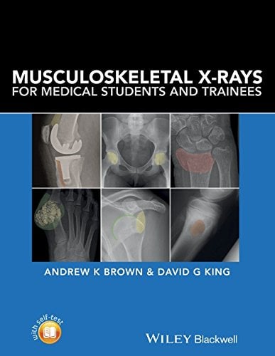 Musculoskeletal X-Rays for Medical Students and Trainees (PDF)