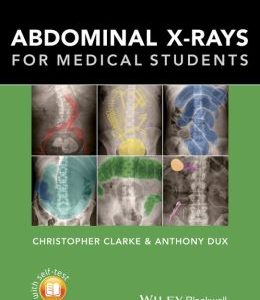 Abdominal X-rays for Medical Students