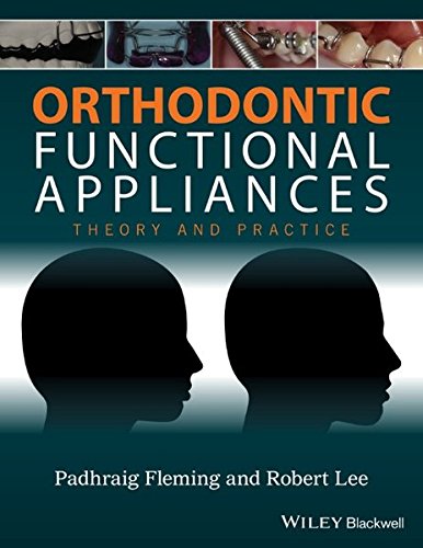 Orthodontic Functional Appliances: Theory and Practice