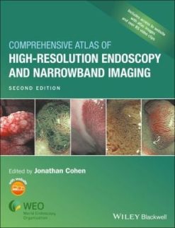 Comprehensive Atlas of High Resolution Endoscopy and Narrowband Imaging, 2nd Edition (PDF)