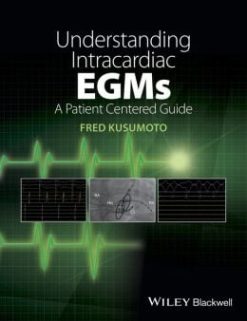 Understanding Intracardiac EGMs: A Patient Centered Guide (Original PDF from Publisher)
