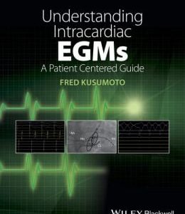 Understanding Intracardiac EGMs: A Patient Centered Guide (Original PDF from Publisher)