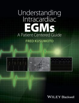 Understanding Intracardiac EGMs: A Patient Centered Guide (Original PDF from Publisher)