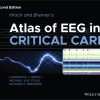 Hirsch and Brenner’s Atlas of EEG in Critical Care, 2nd Edition (EPUB)