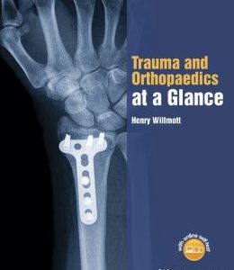 Trauma and Orthopaedics at a Glance