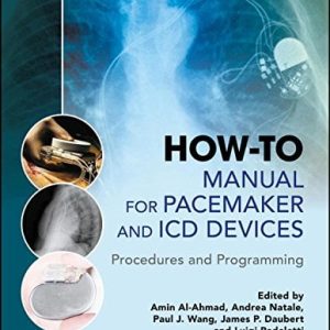 How-to Manual for Pacemaker and ICD Devices: Procedures and Programming (EPUB)