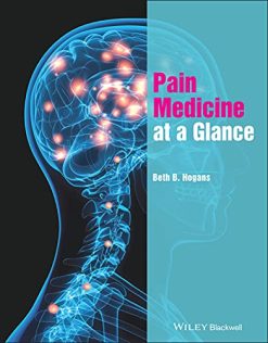 Pain Medicine at a Glance (EPUB)