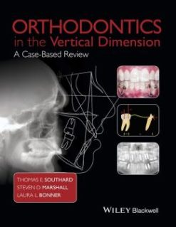 Orthodontics in the Vertical Dimension: A Case-based Review (Original PDF from Publisher)