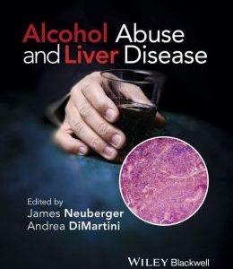 Alcohol Abuse and Liver Disease