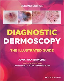 Diagnostic Dermoscopy: The Illustrated Guide, 2nd edition (Original PDF from Publisher)