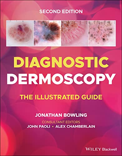 Diagnostic Dermoscopy: The Illustrated Guide, 2nd edition (Original PDF from Publisher)