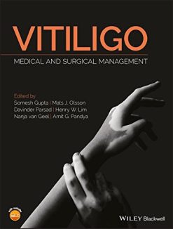 Vitiligo: Medical and Surgical Managmement (PDF)