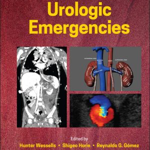 A Clinical Guide to Urologic Emergencies (EPUB)