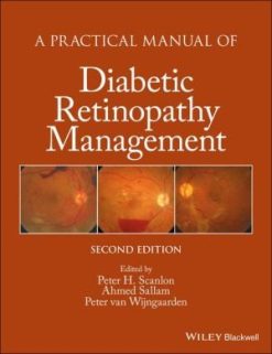 A Practical Manual of Diabetic Retinopathy Management, 2nd Edition (EPUB)