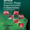 Vertical Alveolar Ridge Augmentation in Implant Dentistry