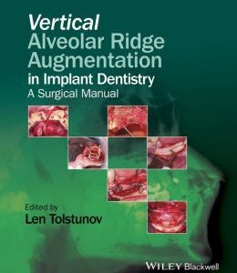 Vertical Alveolar Ridge Augmentation in Implant Dentistry