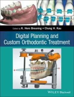 Digital Planning and Custom Orthodontic Treatment (EPUB)