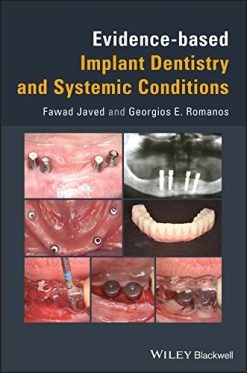 Evidence-based Implant Dentistry and Systemic Conditions (PDF)