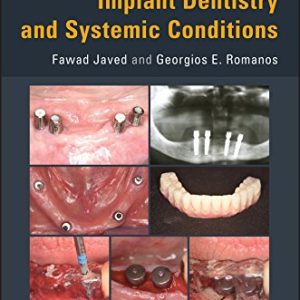 Evidence-based Implant Dentistry and Systemic Conditions (PDF)
