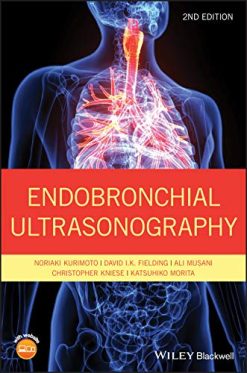 Endobronchial Ultrasonography, 2nd Edition (Original PDF from Publisher)