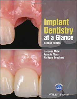 Implant Dentistry at a Glance, 2nd Edition (Original PDF from Publisher)