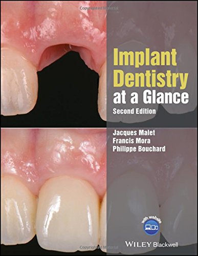 Implant Dentistry at a Glance, 2nd Edition (Original PDF from Publisher)