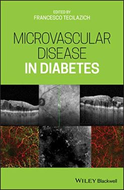 Microvascular Disease in Diabetes  (Original PDF from Publisher)