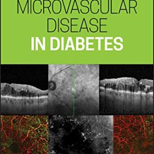 Microvascular Disease in Diabetes  (Original PDF from Publisher)