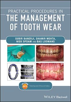 Practical Procedures in the Management of Tooth Wear (Original PDF from Publisher)